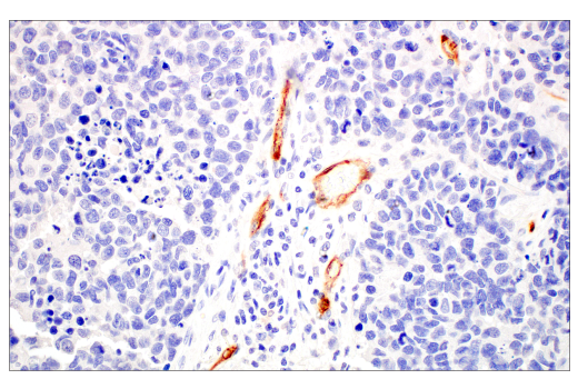 Immunohistochemistry Image 4: PLVAP (E3X9D) Rabbit mAb