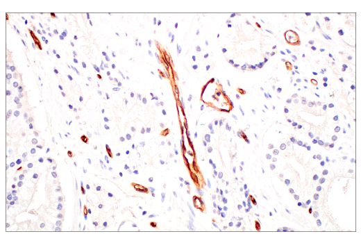 Immunohistochemistry Image 6: PLVAP (E3X9D) Rabbit mAb