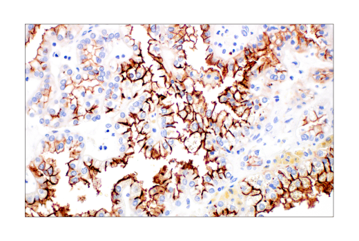 Immunohistochemistry Image 5: ACE2 (E9G3S) Mouse mAb