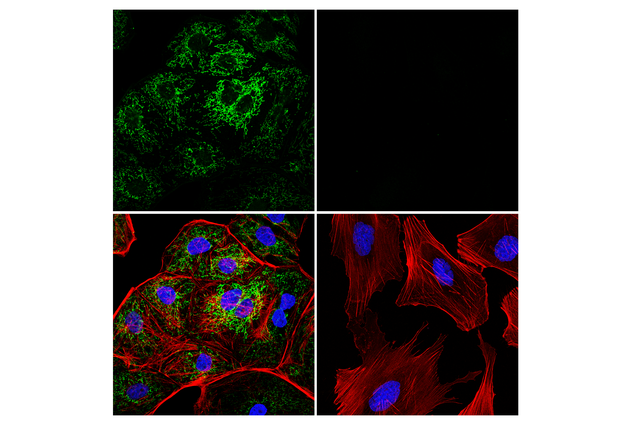 Immunofluorescence Image 1: MTHFD2 (E7A4L) XP® Rabbit mAb (Alexa Fluor® 555 Conjugate)