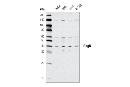 Western Blotting Image 1: RagB Antibody