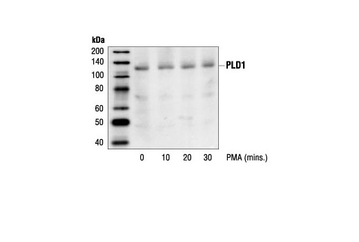Western Blotting Image 1: PLD1 Antibody