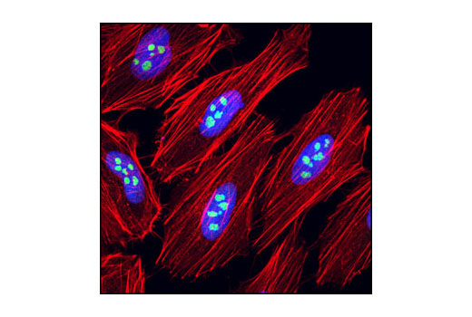 Immunofluorescence Image 1: eIF6 (D16E9) XP® Rabbit mAb