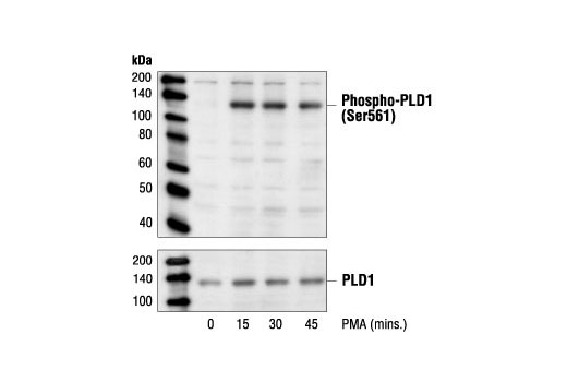 Western Blotting Image 1: Phospho-PLD1 (Ser561) Antibody