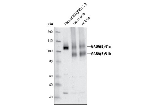Western Blotting Image 1: GABA(B)R1 Antibody