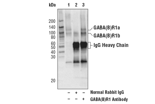 Immunoprecipitation Image 1: GABA(B)R1 Antibody