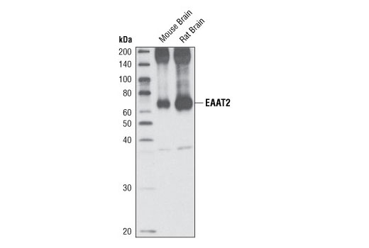Western Blotting Image 1: EAAT2 Antibody