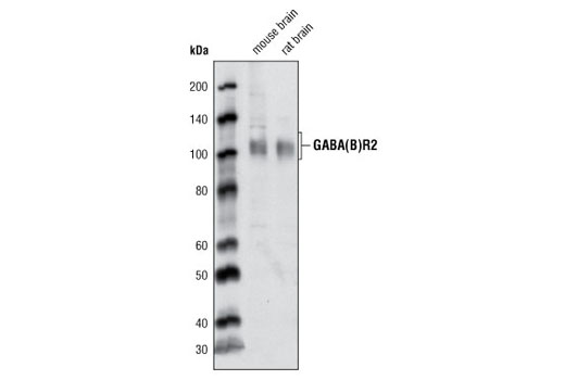Western Blotting Image 1: GABA(B)R2 Antibody