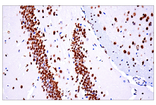 Immunohistochemistry Image 2: TDP43 (E2G6G) Rabbit mAb (BSA and Azide Free)