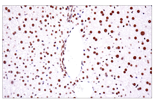 Immunohistochemistry Image 4: TDP43 (E2G6G) Rabbit mAb (BSA and Azide Free)