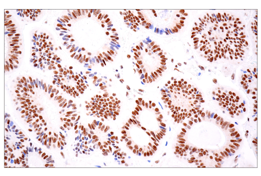 Immunohistochemistry Image 11: TDP43 (E2G6G) Rabbit mAb (BSA and Azide Free)