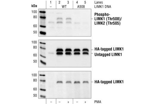 Western Blotting Image 1: Phospho-LIMK1 (Thr508)/LIMK2 (Thr505) Antibody