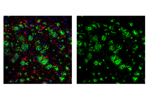 Immunofluorescence Image 1: β-Amyloid (D54D2) XP® Rabbit mAb (BSA and Azide Free)