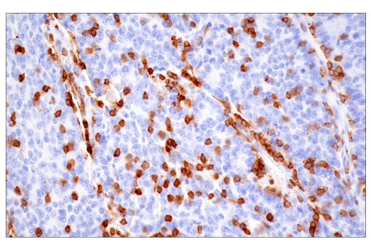 Immunohistochemistry Image 4: CD43 (MT1) Mouse mAb