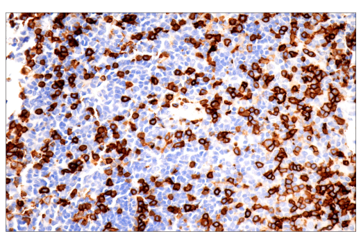 Immunohistochemistry Image 3: CD43 (MT1) Mouse mAb