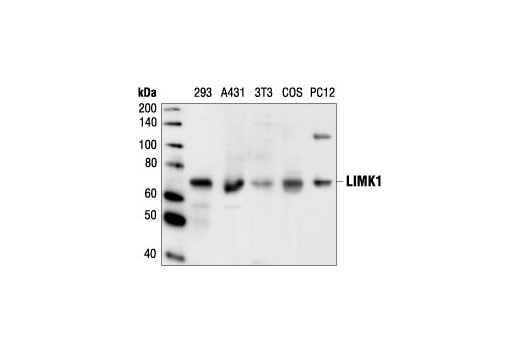 Western Blotting Image 1: LIMK1 Antibody