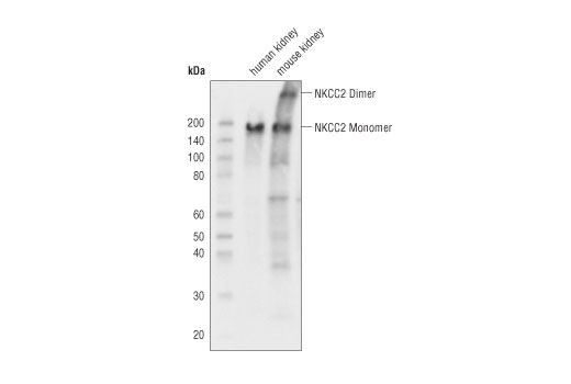 Western Blotting Image 1: NKCC2 Antibody