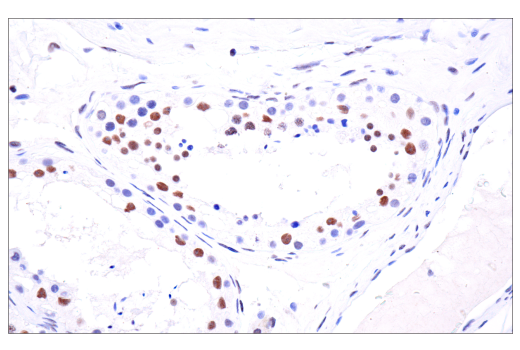  Image 68: BAF Complex IHC Antibody Sampler Kit