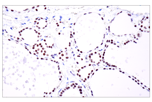  Image 76: BAF Complex IHC Antibody Sampler Kit