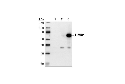 Western Blotting Image 1: LIMK2 Antibody