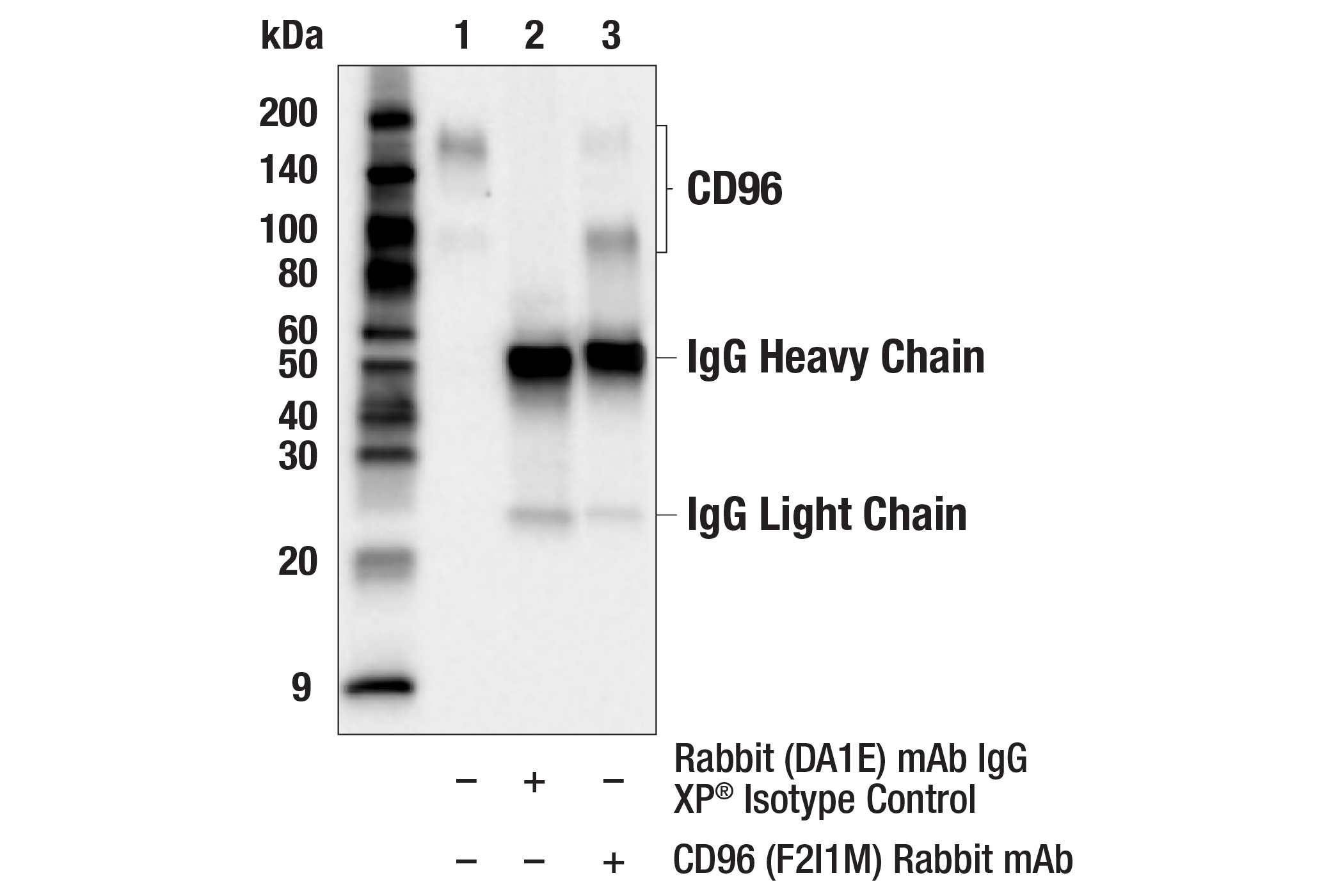 Immunoprecipitation Image 1: CD96 (F2I1M) Rabbit mAb
