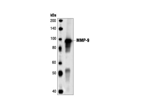 Western Blotting Image 2: MMP-9 Antibody