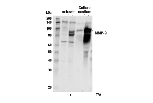 Western Blotting Image 1: MMP-9 Antibody