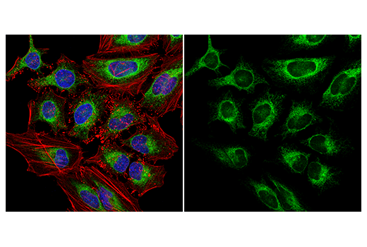 Immunofluorescence Image 1: Calnexin (C5C9) Rabbit mAb (Alexa Fluor® 488 Conjugate)