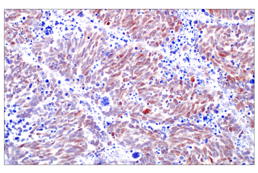 Immunohistochemistry Image 3: POU2F3 (E5N2D) XP® Rabbit mAb (BSA and Azide Free)