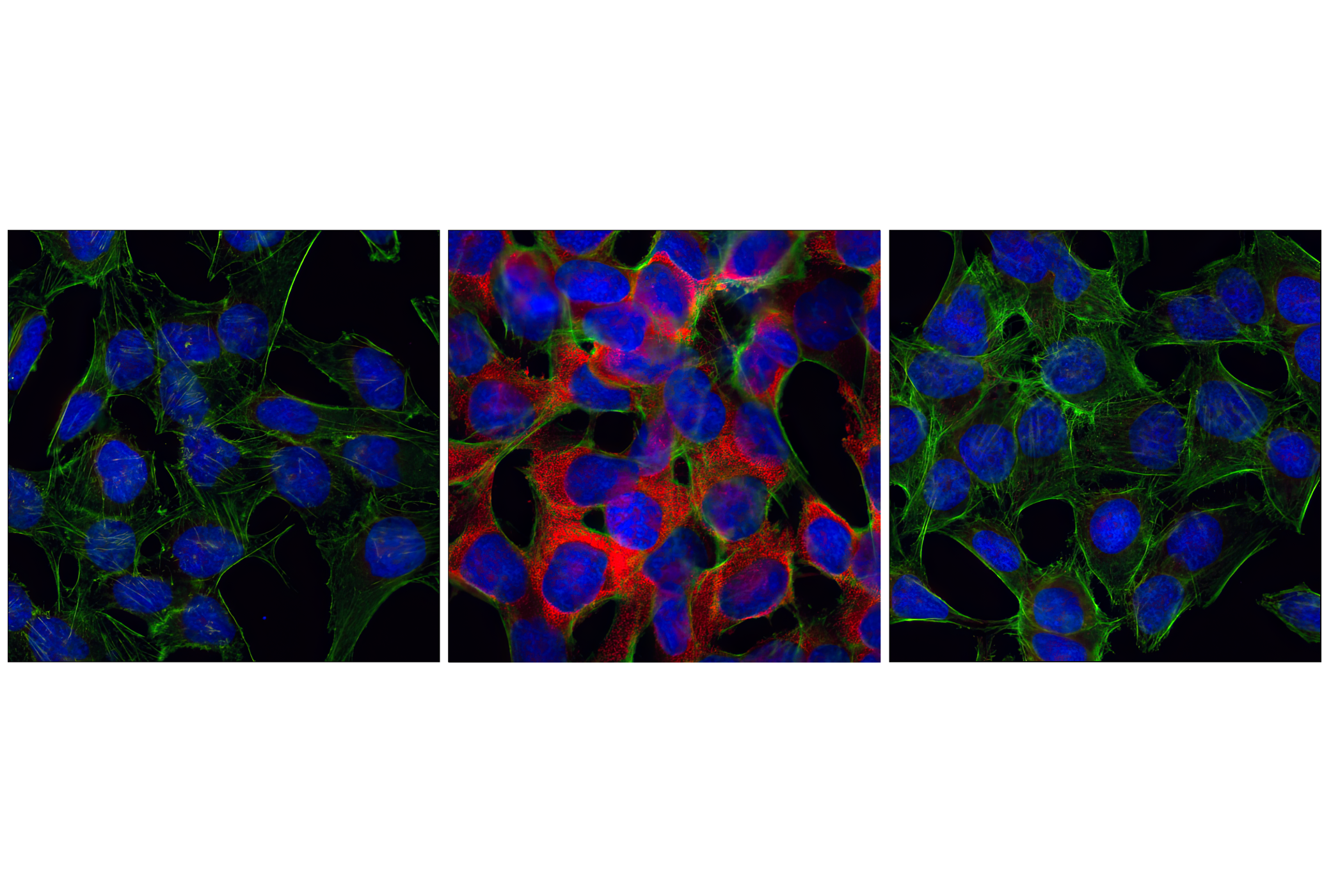 Immunofluorescence Image 1: Phospho-S6 Ribosomal Protein (Ser235/236) (91B2) Rabbit mAb (BSA and Azide Free)