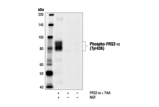 Western Blotting Image 1: Phospho-FRS2-α (Tyr436) Antibody