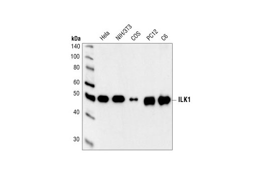Western Blotting Image 1: ILK1 Antibody