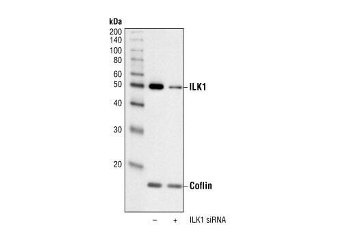 Western Blotting Image 2: ILK1 Antibody