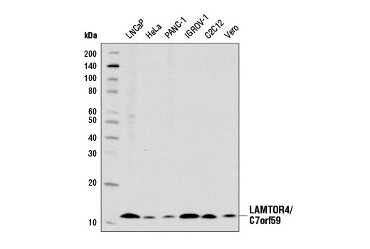Western Blotting Image 1: LAMTOR4/C7orf59 (D4P6O) Rabbit mAb (BSA and Azide Free)