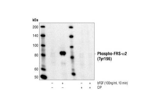 Western Blotting Image 1: Phospho-FRS2-α (Tyr196) Antibody