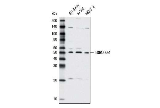 Western Blotting Image 1: nSMase1 Antibody