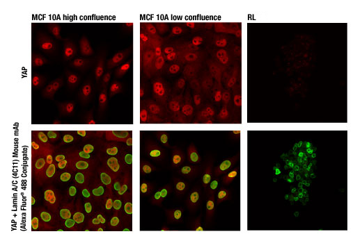 Immunofluorescence Image 1: YAP (D8H1X) XP® Rabbit mAb (Alexa Fluor® 647 Conjugate)