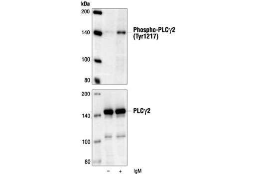 Western Blotting Image 1: Phospho-PLCγ2 (Tyr1217) Antibody