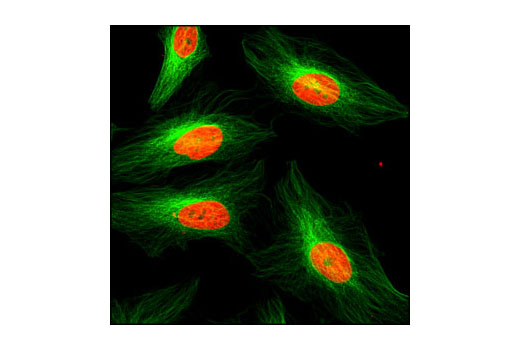 Immunofluorescence Image 1: α-Tubulin (DM1A) Mouse mAb
