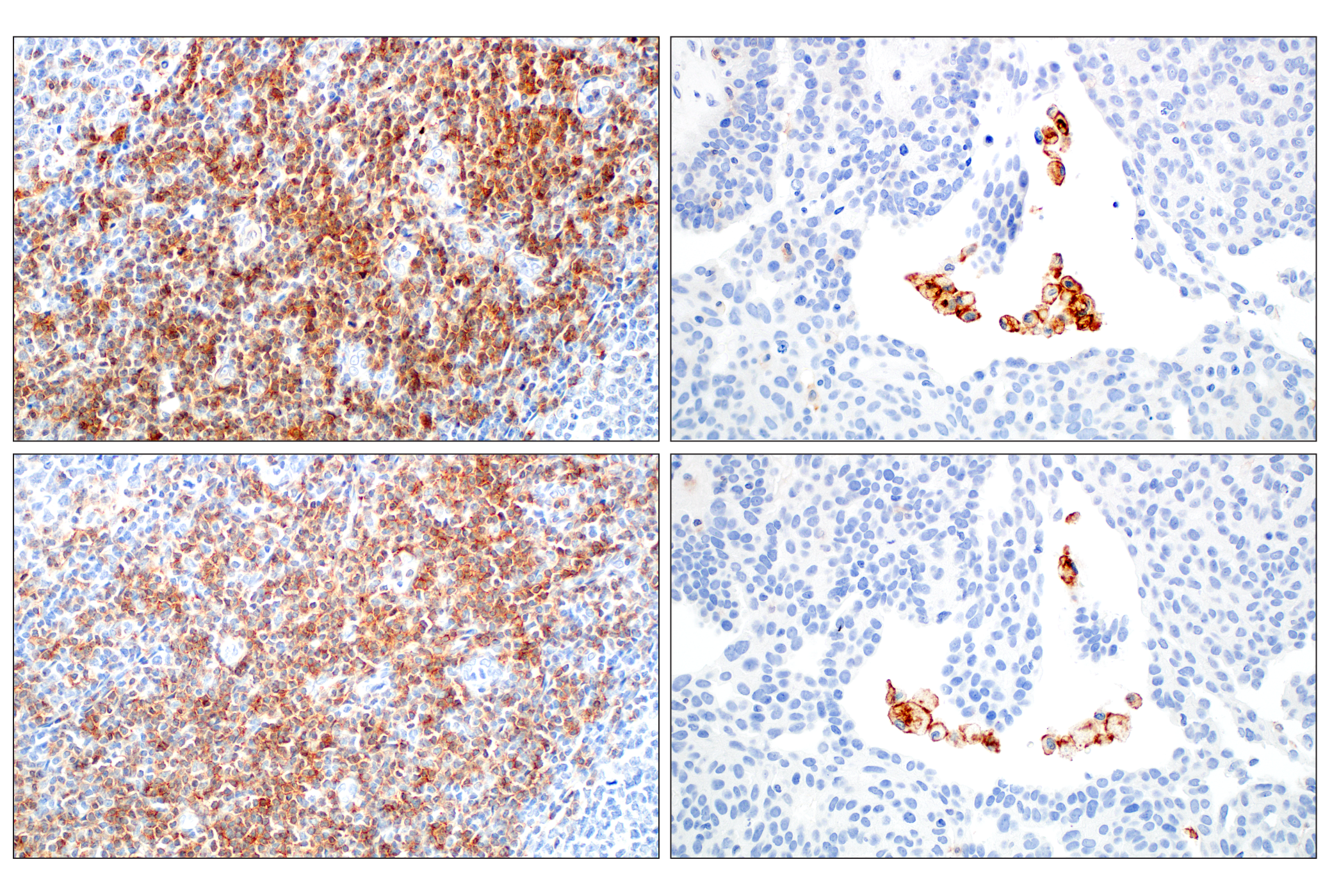 Immunohistochemistry Image 7: CD28 (D2Z4E) Rabbit mAb