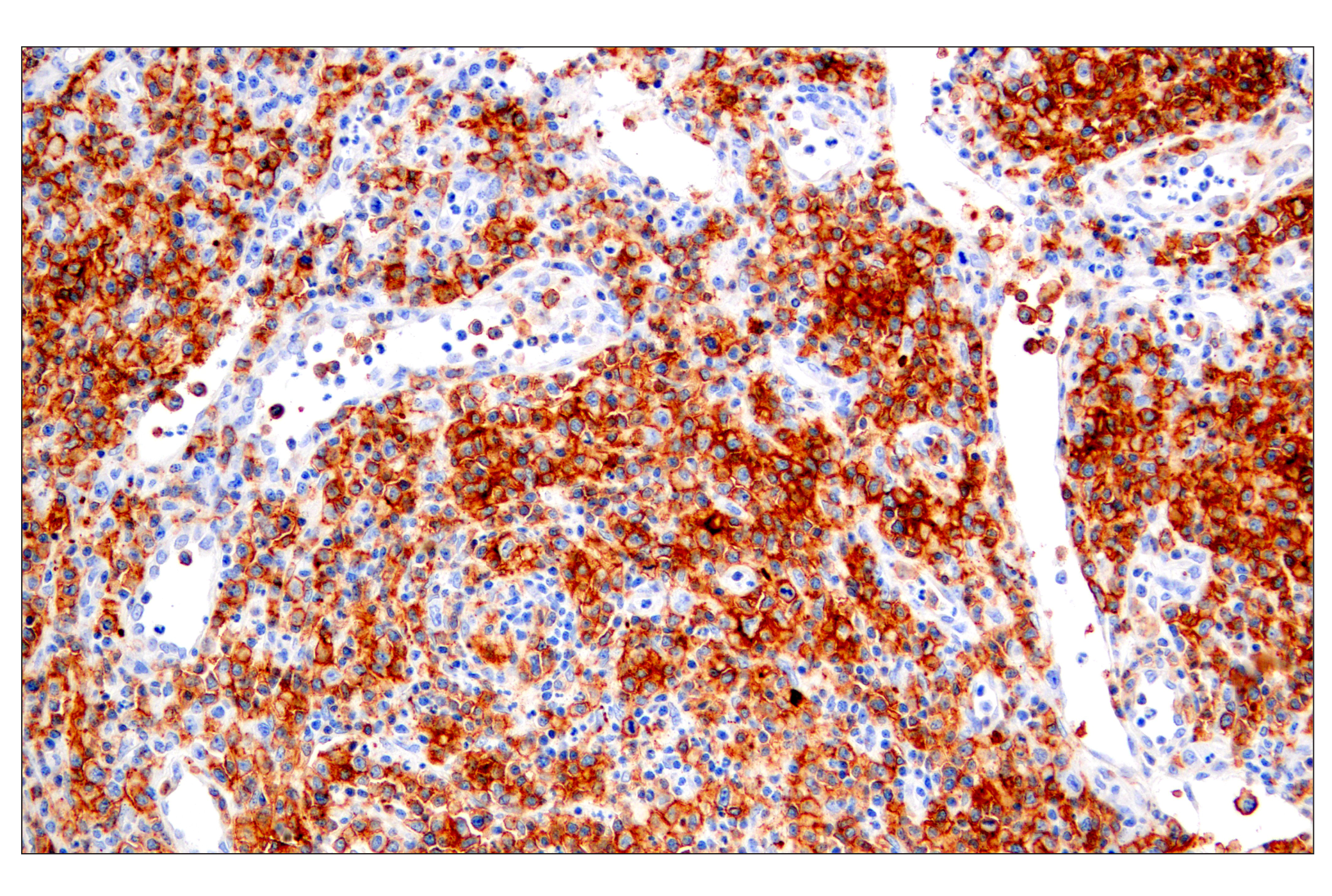 Immunohistochemistry Image 1: CD28 (D2Z4E) Rabbit mAb