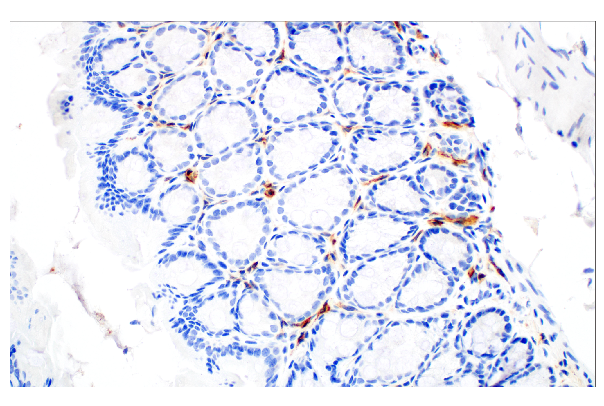 Immunohistochemistry Image 5: CD28 (D2Z4E) Rabbit mAb