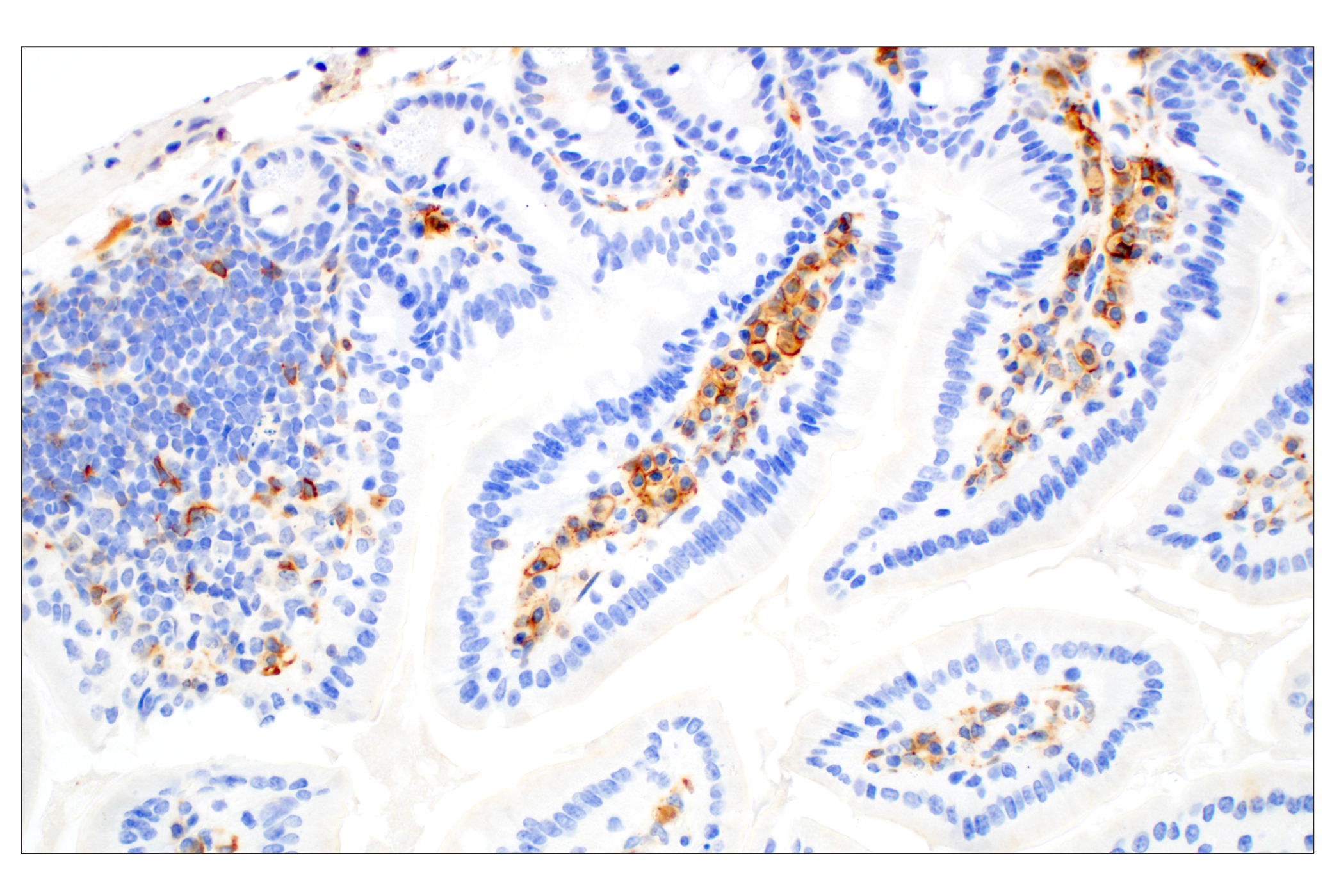 Immunohistochemistry Image 6: CD28 (D2Z4E) Rabbit mAb