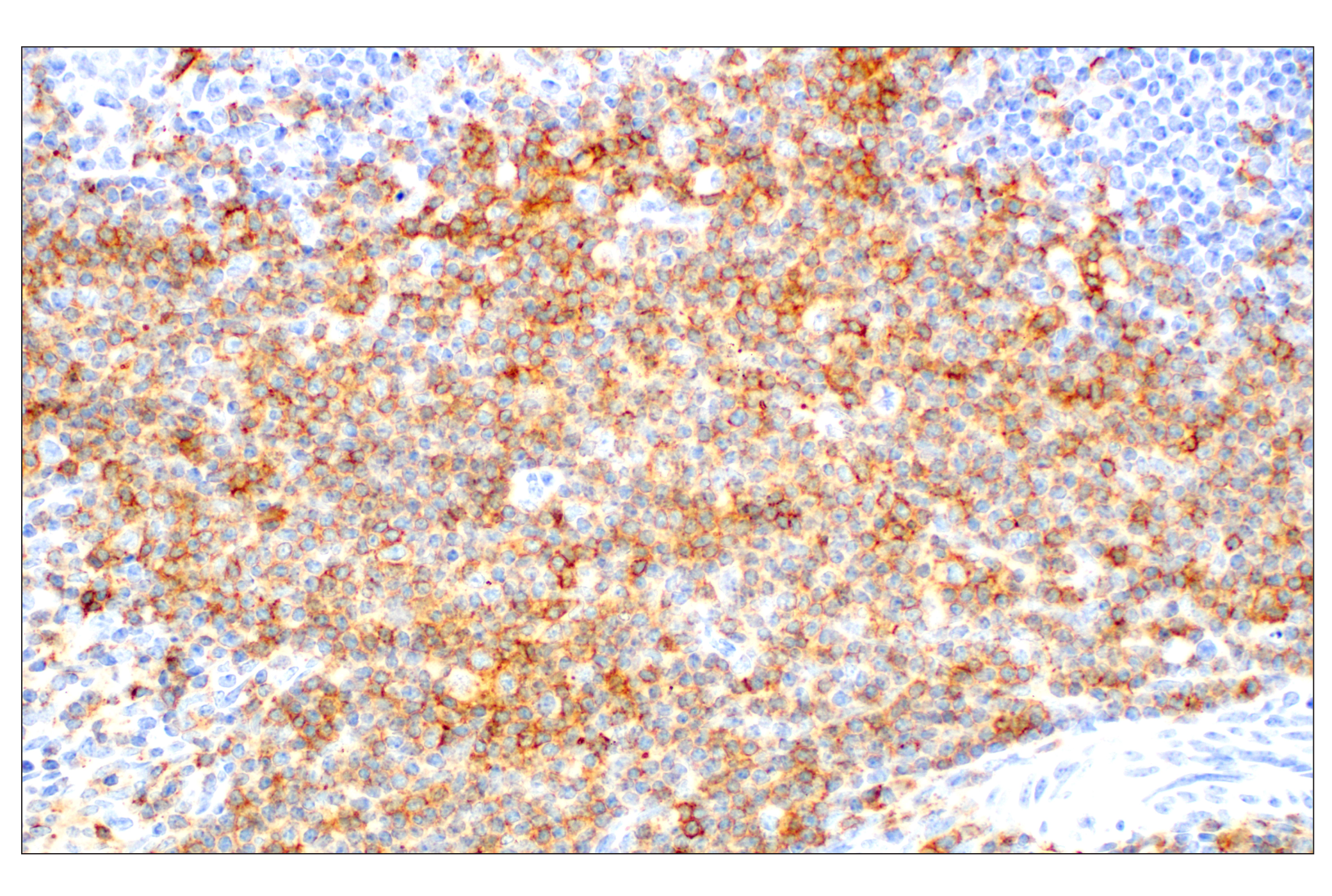 Immunohistochemistry Image 3: CD28 (D2Z4E) Rabbit mAb