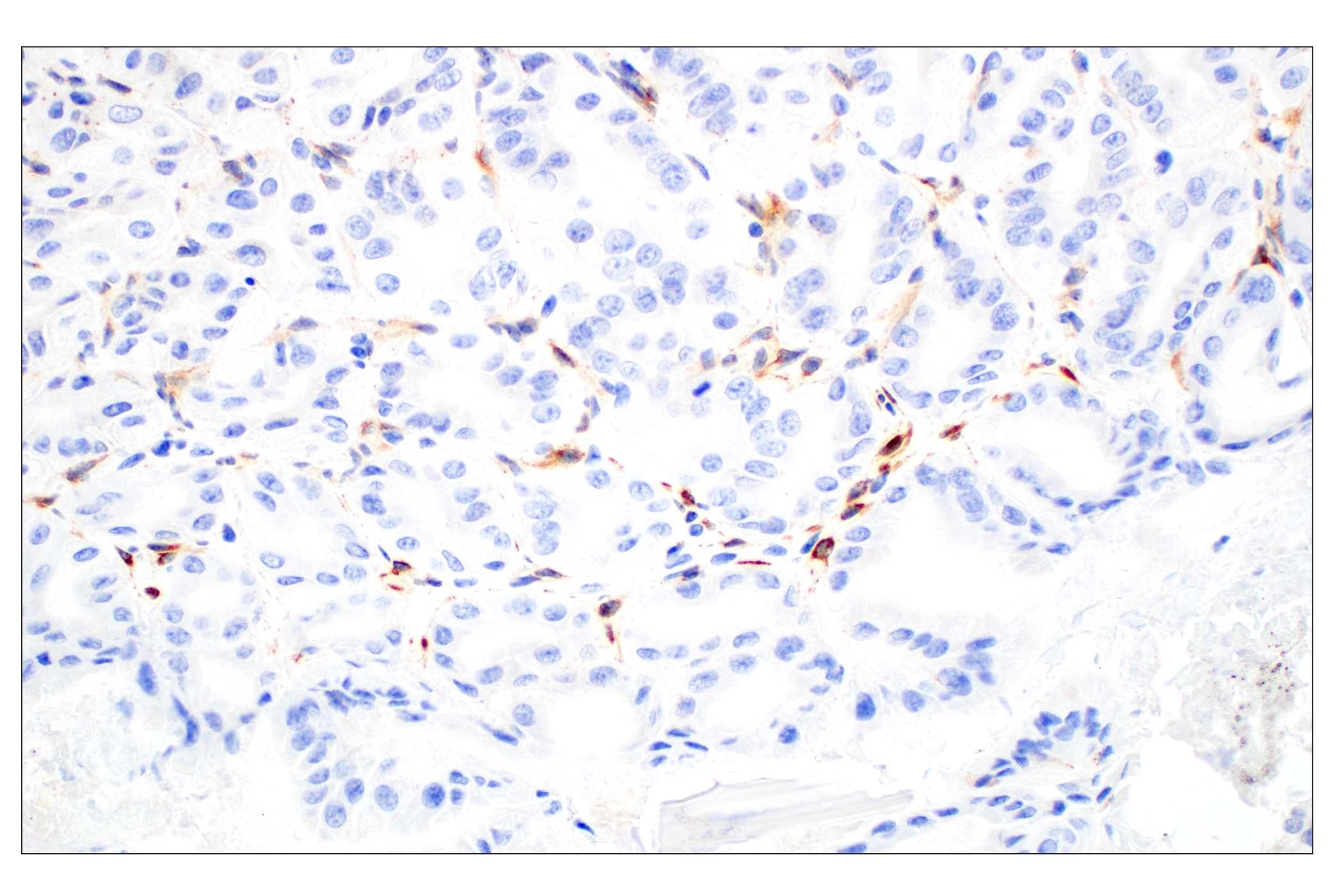Immunohistochemistry Image 4: CD28 (D2Z4E) Rabbit mAb
