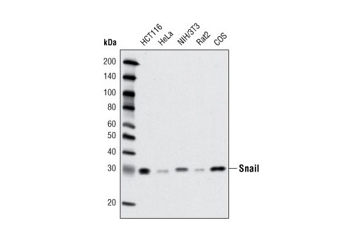  Image 9: Epithelial-Mesenchymal Transition (EMT) Antibody Sampler Kit
