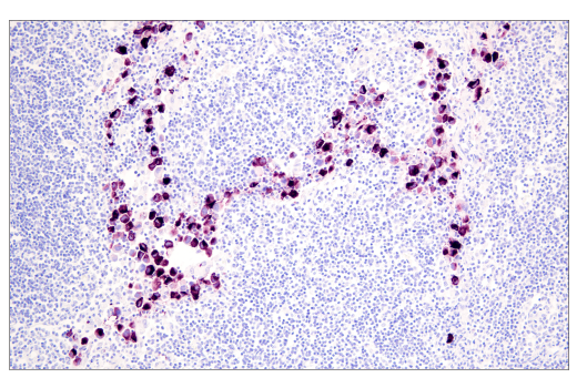 Immunohistochemistry Image 2: PMEL/Melanoma gp100 (HMB45) Mouse mAb