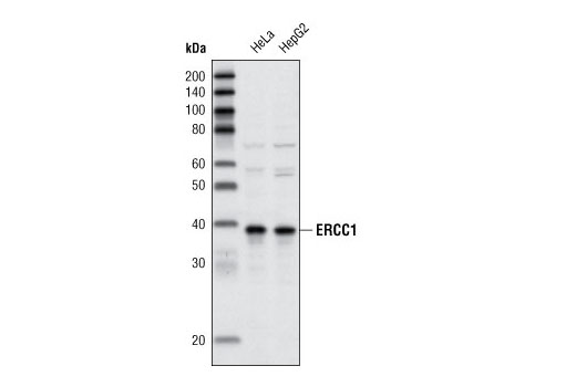 Western Blotting Image 1: ERCC1 Antibody