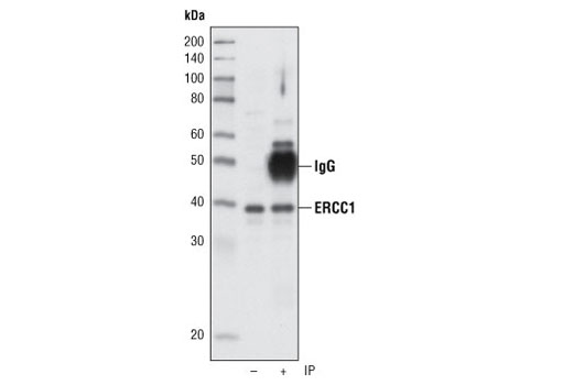 Immunoprecipitation Image 1: ERCC1 Antibody