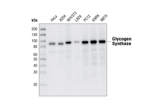  Image 1: PhosphoPlus® Glycogen Synthase (Ser641) Antibody Duet